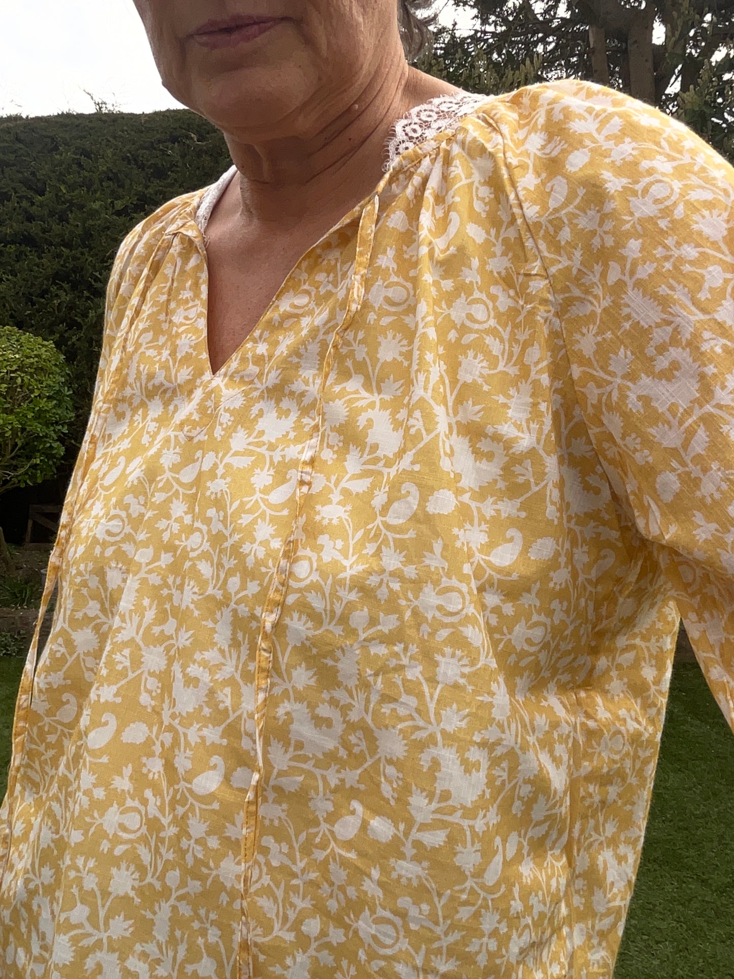 Barletta yellow top